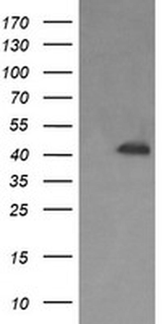PARVA Antibody in Western Blot (WB)