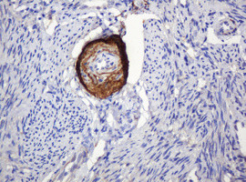PARVB Antibody in Immunohistochemistry (Paraffin) (IHC (P))