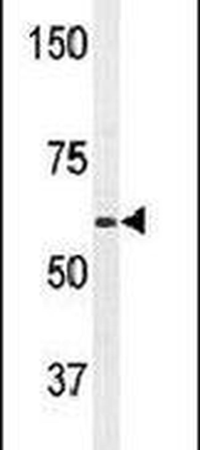 PAT1 Antibody in Western Blot (WB)