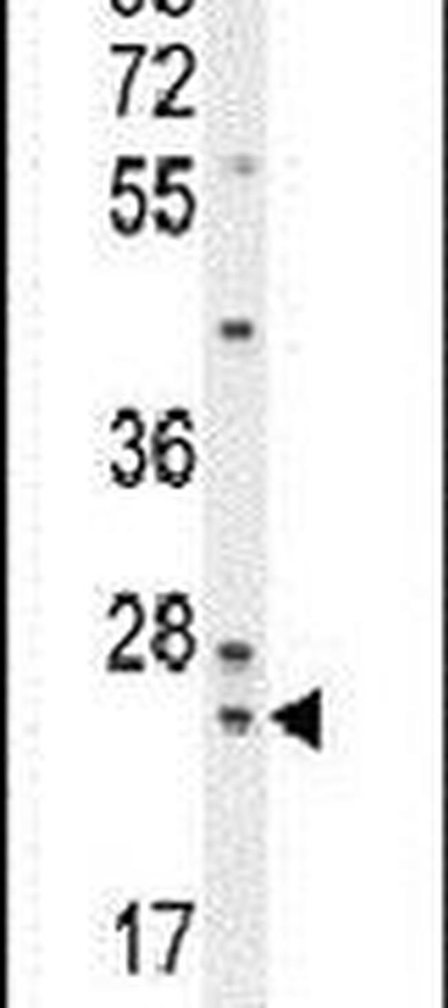 ZG16B Antibody in Western Blot (WB)