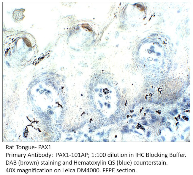 PAX1 Antibody in Immunohistochemistry (IHC)