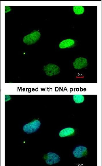 PAX3 Antibody in Immunocytochemistry (ICC/IF)