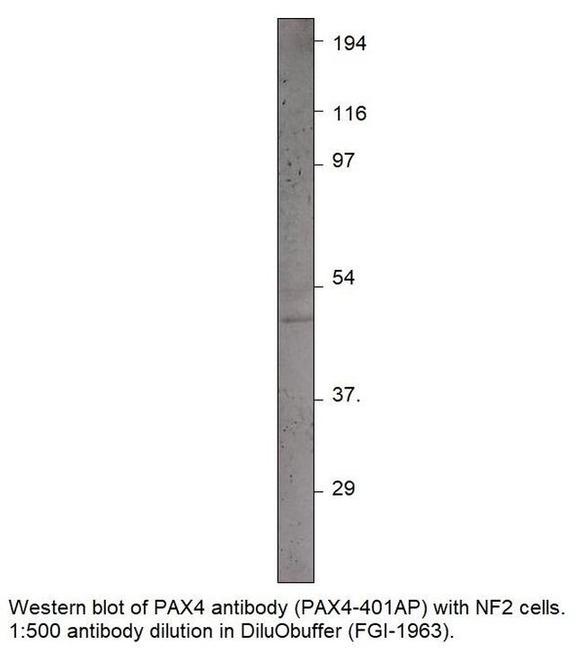 PAX4 Antibody in Western Blot (WB)