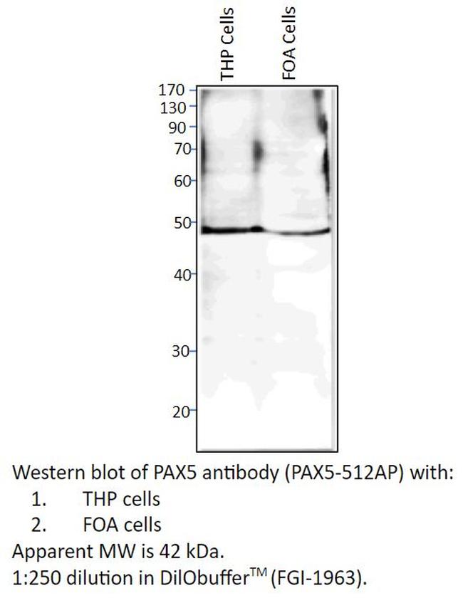 PAX5 Antibody in Western Blot (WB)