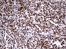 PAX5 Antibody in Immunohistochemistry (Paraffin) (IHC (P))