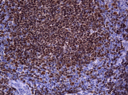 PAX5 Antibody in Immunohistochemistry (Paraffin) (IHC (P))