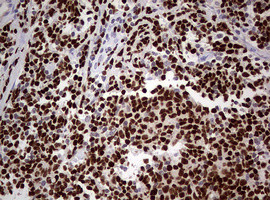 PAX5 Antibody in Immunohistochemistry (Paraffin) (IHC (P))