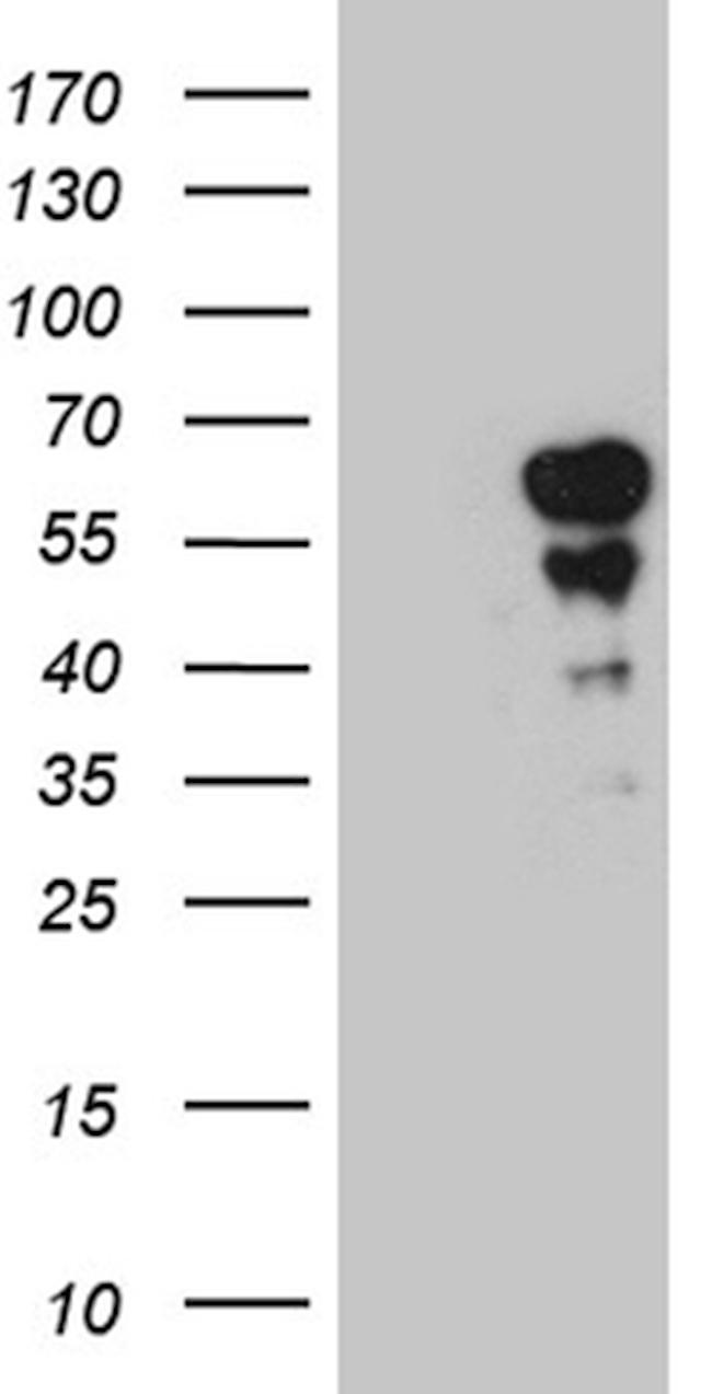 PAX7 Antibody in Western Blot (WB)