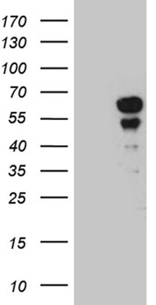 PAX7 Antibody in Western Blot (WB)