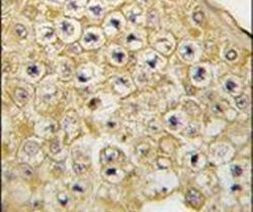 PBK Antibody in Immunohistochemistry (IHC)