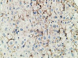 PBLD Antibody in Immunohistochemistry (Paraffin) (IHC (P))