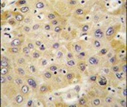 PEBP1 Antibody in Immunohistochemistry (IHC)