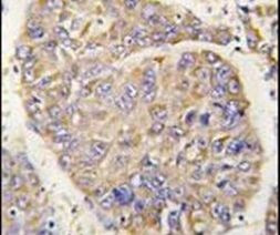 PEBP1 Antibody in Immunohistochemistry (IHC)