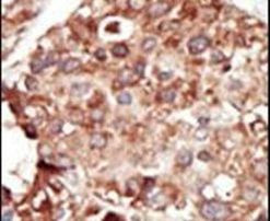 PEBP1 Antibody in Immunohistochemistry (IHC)