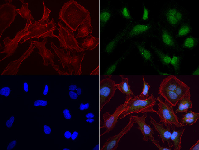 PBX1 Antibody in Immunocytochemistry (ICC/IF)