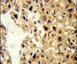 PCBD1 Antibody in Immunohistochemistry (IHC)