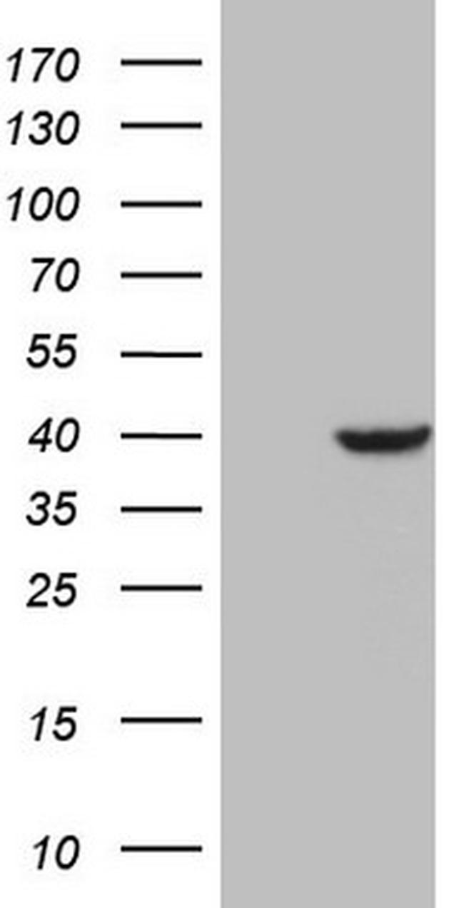 PCBP1 Antibody in Western Blot (WB)