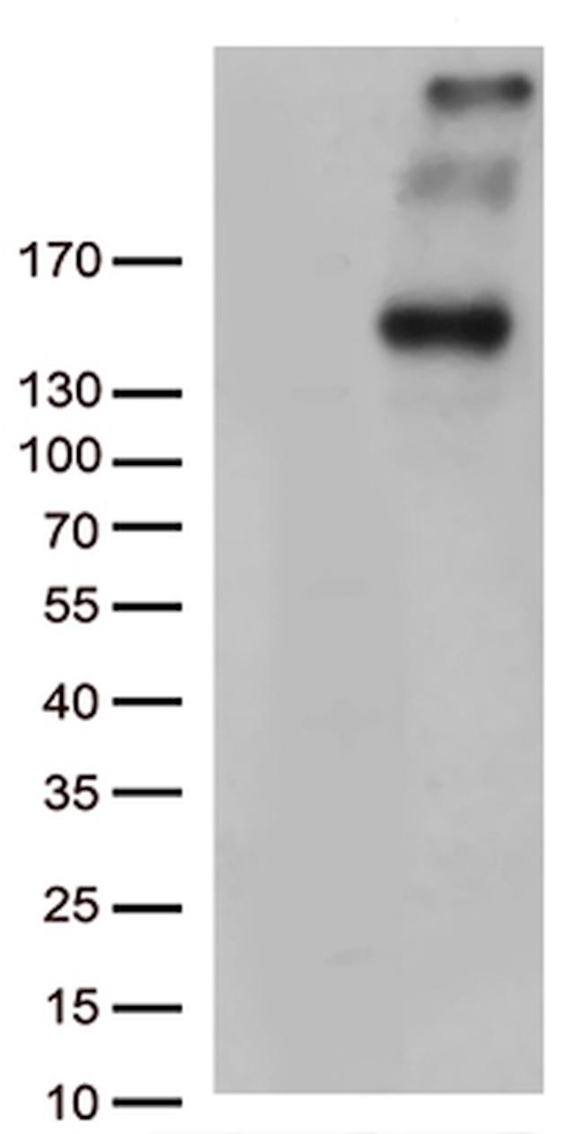 PCDH15 Antibody in Western Blot (WB)
