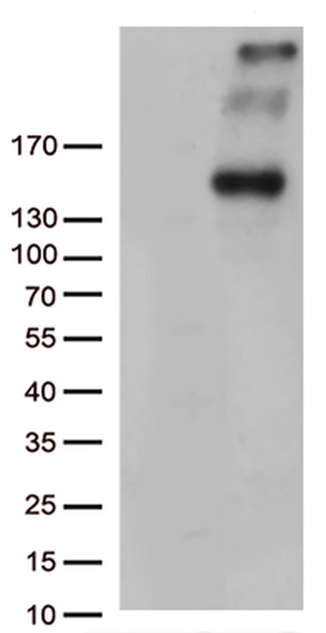 PCDH15 Antibody in Western Blot (WB)
