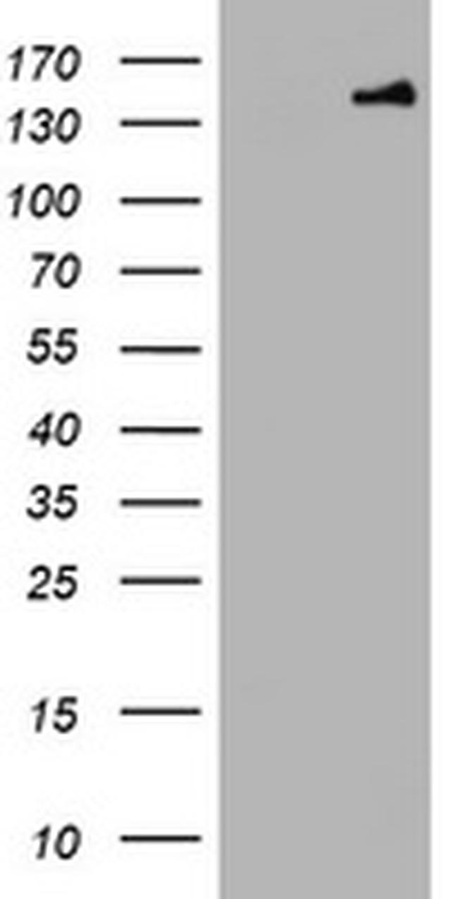 PCDH7 Antibody in Western Blot (WB)