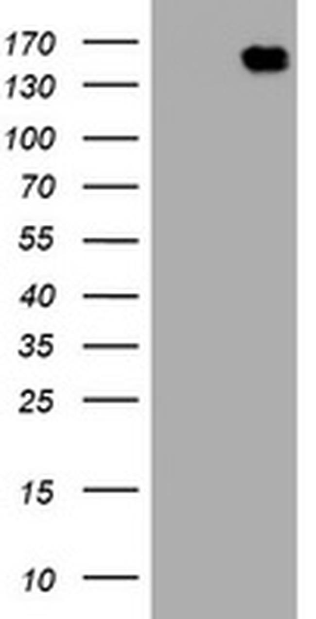 PCDH7 Antibody in Western Blot (WB)