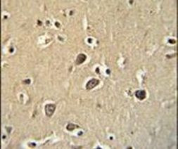 PCDHGC3 Antibody in Immunohistochemistry (IHC)