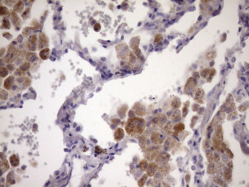 PCDHGC5 Antibody in Immunohistochemistry (Paraffin) (IHC (P))