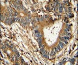 PID1 Antibody in Immunohistochemistry (IHC)