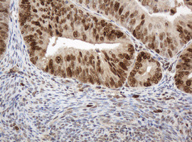 PCNA Antibody in Immunohistochemistry (Paraffin) (IHC (P))