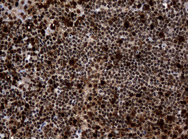 PCNA Antibody in Immunohistochemistry (Paraffin) (IHC (P))