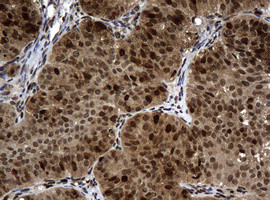 PCNA Antibody in Immunohistochemistry (Paraffin) (IHC (P))