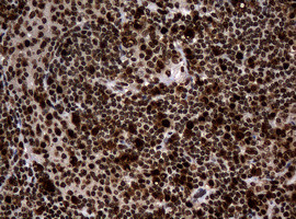 PCNA Antibody in Immunohistochemistry (Paraffin) (IHC (P))