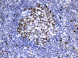 PCNA Antibody in Immunohistochemistry (Paraffin) (IHC (P))