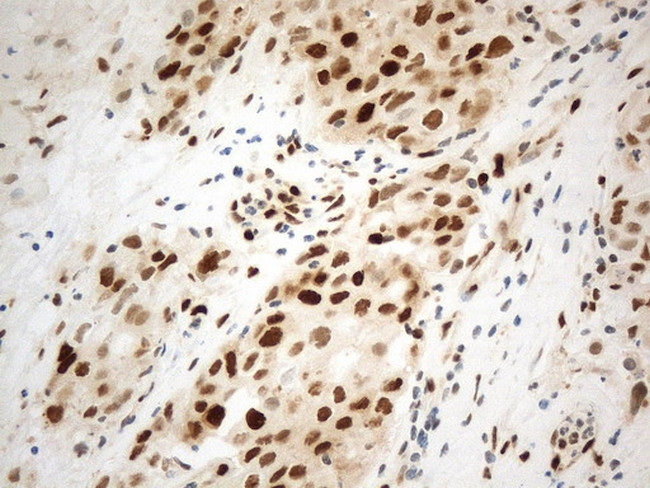 PCNA Antibody in Immunohistochemistry (Paraffin) (IHC (P))