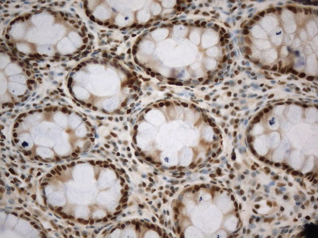 PCNA Antibody in Immunohistochemistry (Paraffin) (IHC (P))