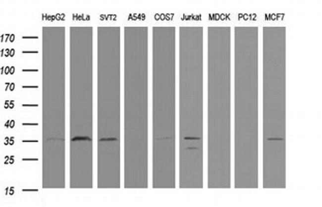 PCNA Antibody in Western Blot (WB)