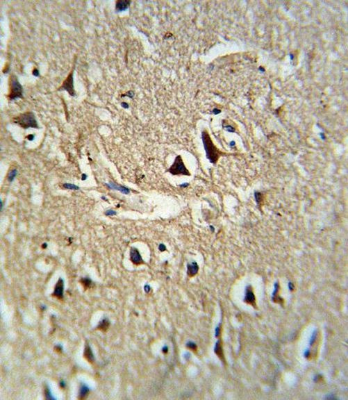 PCSK2 Antibody in Immunohistochemistry (IHC)