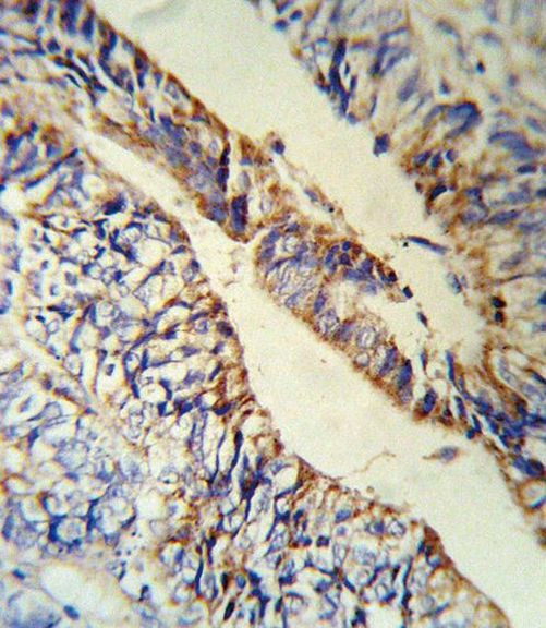 PCSK9 Antibody in Immunohistochemistry (IHC)