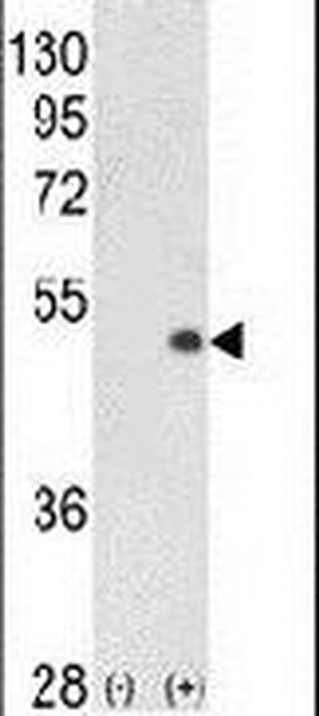 PCTAIRE1 Antibody in Western Blot (WB)