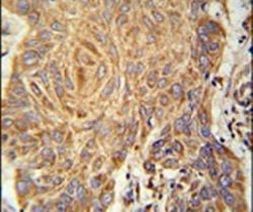 PCYOX1L Antibody in Immunohistochemistry (IHC)