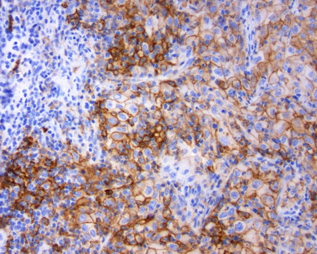 PD-L1 Antibody in Immunohistochemistry (Paraffin) (IHC (P))