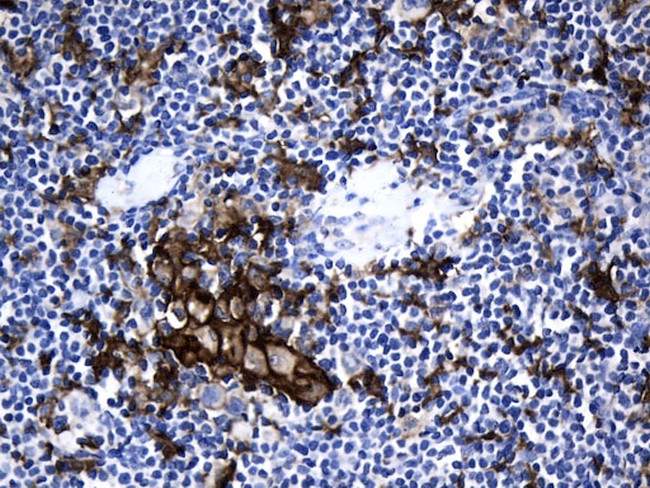 PD-L1 Antibody in Immunohistochemistry (Paraffin) (IHC (P))