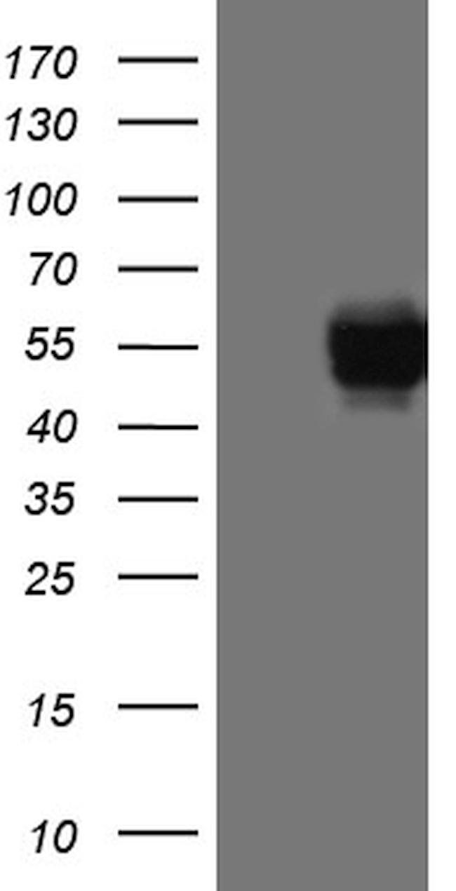 PD-L1 Antibody in Western Blot (WB)