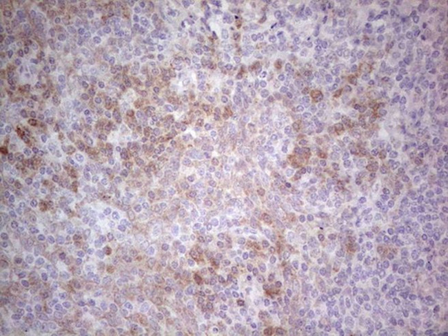 PD-L2 (PDCD1LG2) Antibody in Immunohistochemistry (Paraffin) (IHC (P))