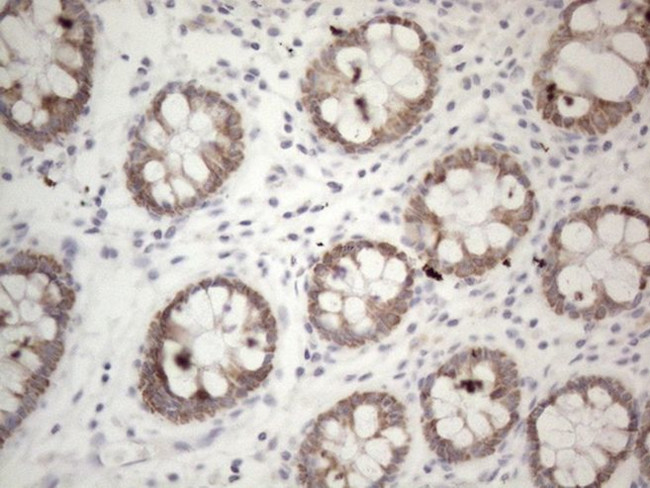 PD-L2 (PDCD1LG2) Antibody in Immunohistochemistry (Paraffin) (IHC (P))