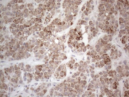 PD-L2 (PDCD1LG2) Antibody in Immunohistochemistry (Paraffin) (IHC (P))
