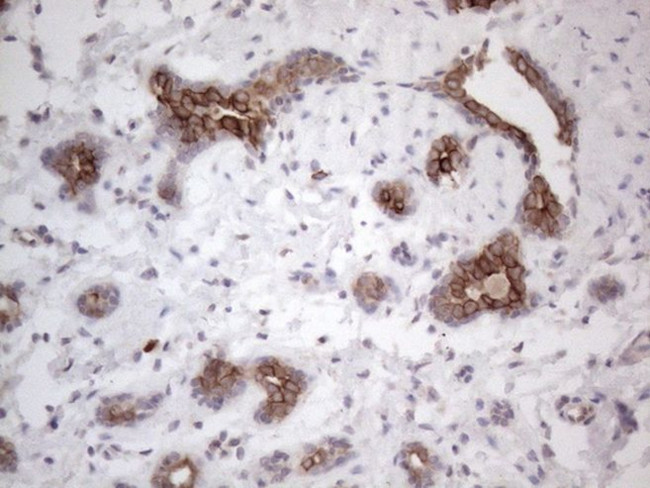 PD-L2 (PDCD1LG2) Antibody in Immunohistochemistry (Paraffin) (IHC (P))