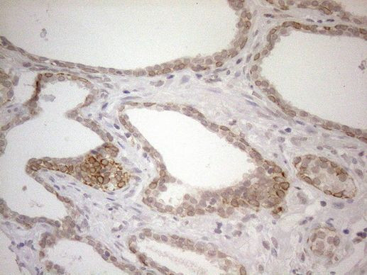 PD-L2 (PDCD1LG2) Antibody in Immunohistochemistry (Paraffin) (IHC (P))