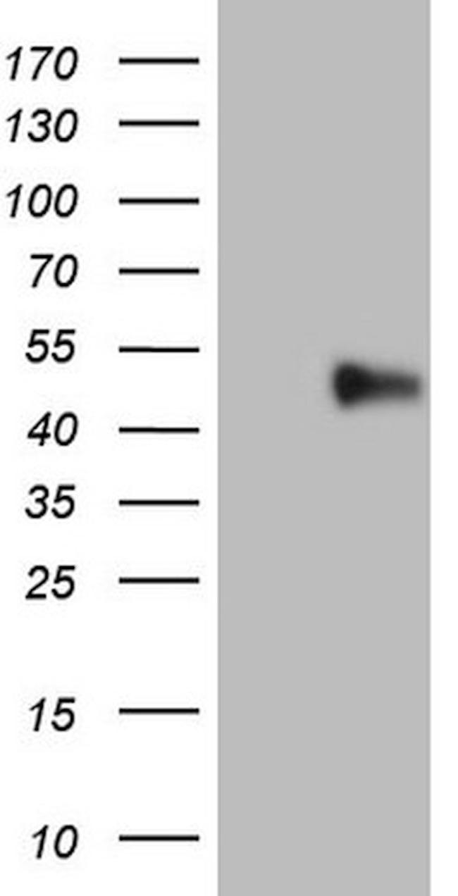 PD-L2 (PDCD1LG2) Antibody in Western Blot (WB)