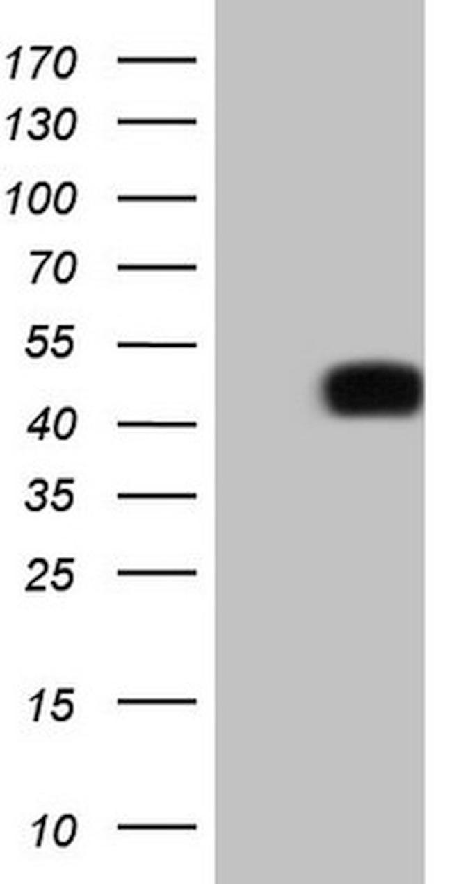 PD-L2 (PDCD1LG2) Antibody in Western Blot (WB)